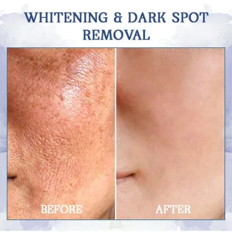   : 85%    & - : Restore Skin Elasticity