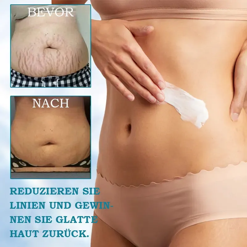   : 85%    & - : Restore Skin Elasticity
