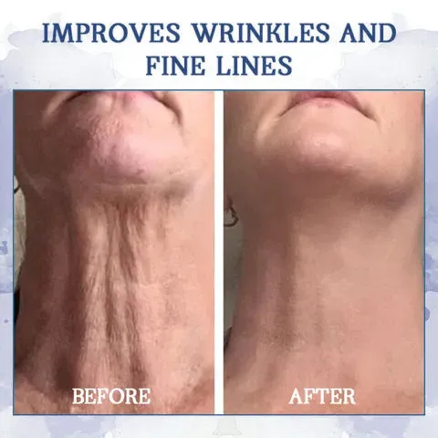   : 85%    & - : Restore Skin Elasticity