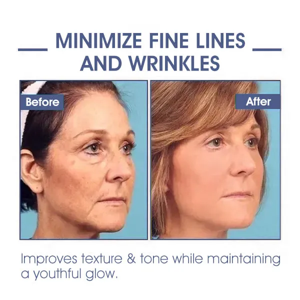   : 85%    & - : Restore Skin Elasticity