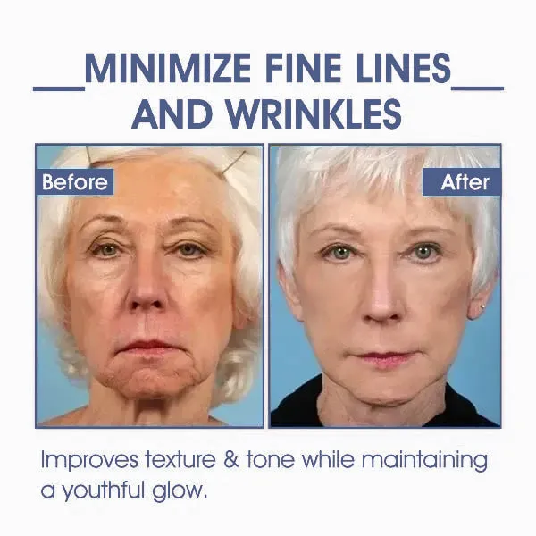   : 85%    & - : Restore Skin Elasticity
