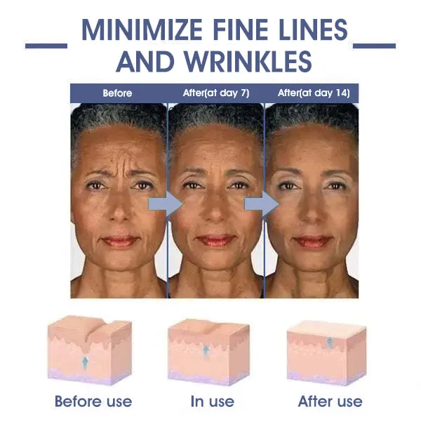   : 85%    & - : Restore Skin Elasticity