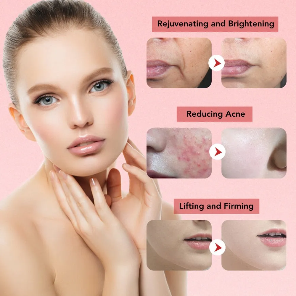 7 in 1 Face Lift Devices EMS RF Microcurrent Skin Rejuvenation Facial Massager Light Therapy Anti Aging Wrinkle
