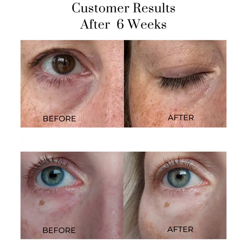 OSKIA Eye Wonder Nutri-Active Eye Serum
